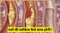 blocked arteries in legs