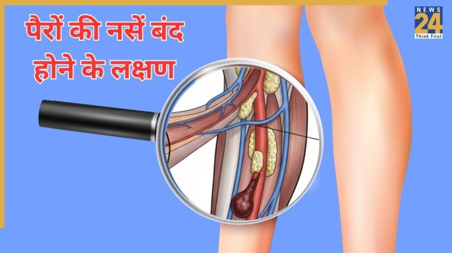 blocked Arteries In Legs