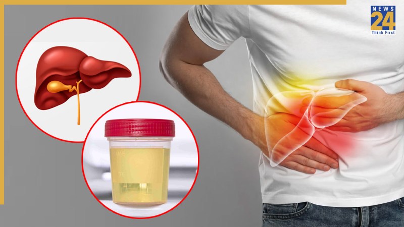 fatty liver signs