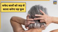 White Hair Home Remedies