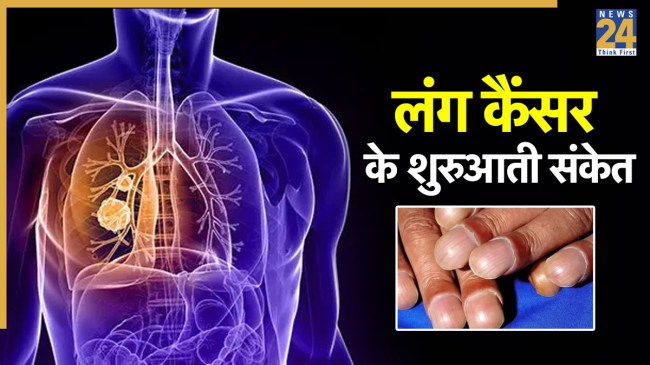 lung cancer symptoms