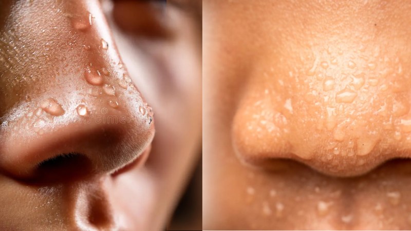 sweating-on-nose
