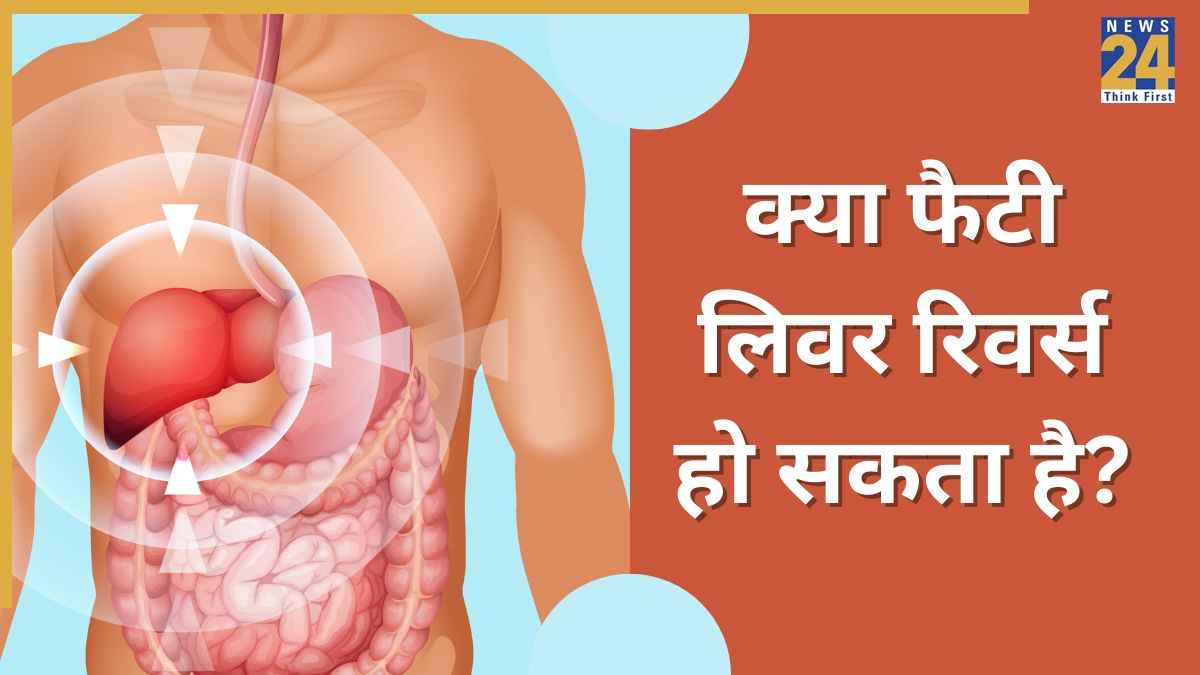 Fatty Liver Disease