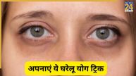 dark circles