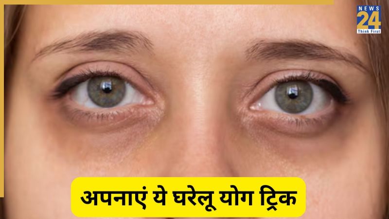 dark circles