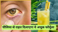 this juice can cure from Jaundice
