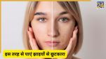 Pigmentation Homemade Cream