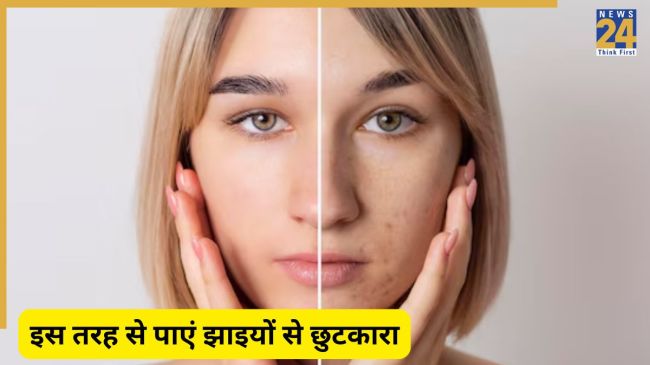 Pigmentation Homemade Cream Pigmentation Homemade Cream