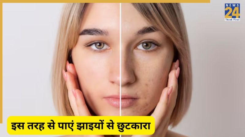 Pigmentation Homemade Cream