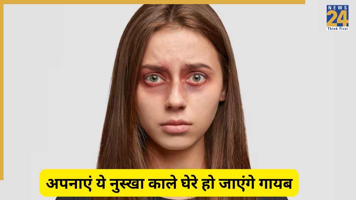 Dark Circle: डार्क सर्कल्स से परेशान हैं? अपनाएं आयुर्वेदिक डॉक्टर उपासना वोहरा का ये नुस्खा