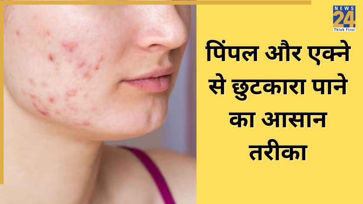 homemade Acne Free face spray