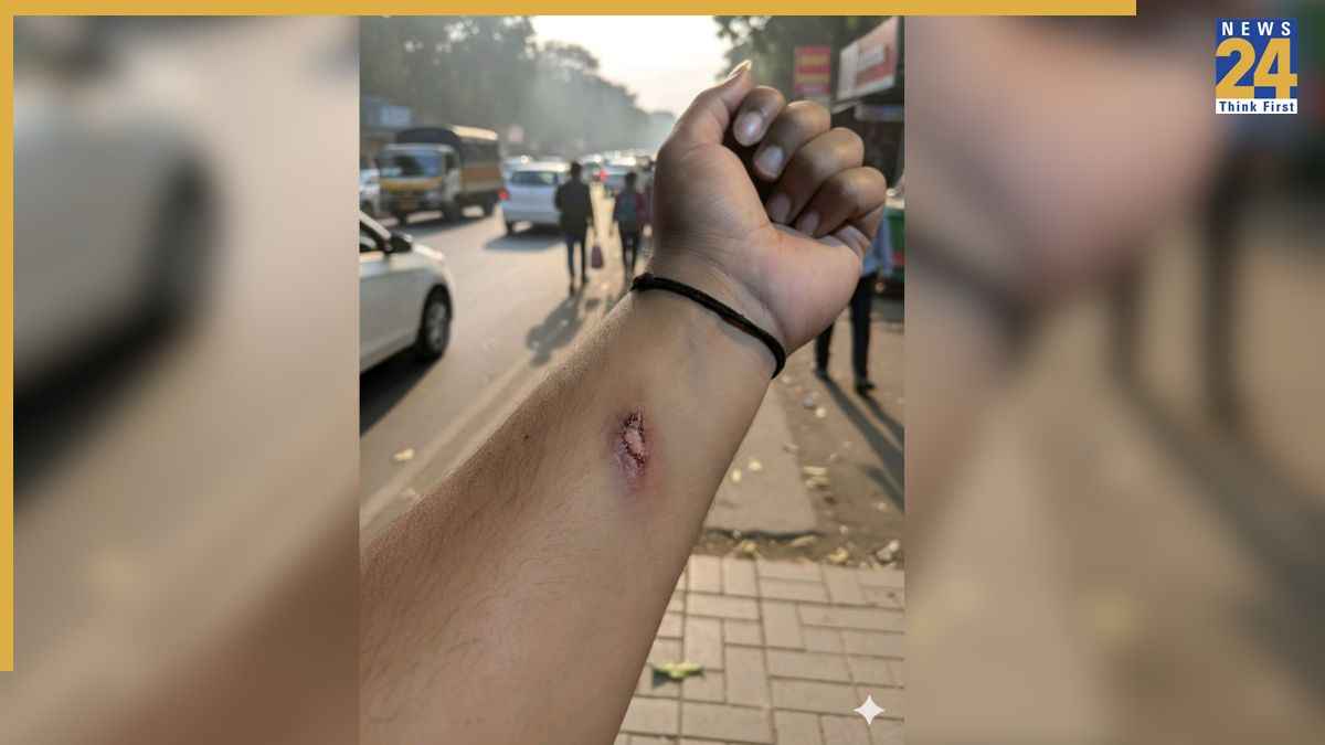 नौकरी बाद में छीनेगा AI… पहले छुट्टी दिलाने में कर रहा मदद, हाथ पर बनाया चोट का ऐसा निशान, HR ने मान लिया सच