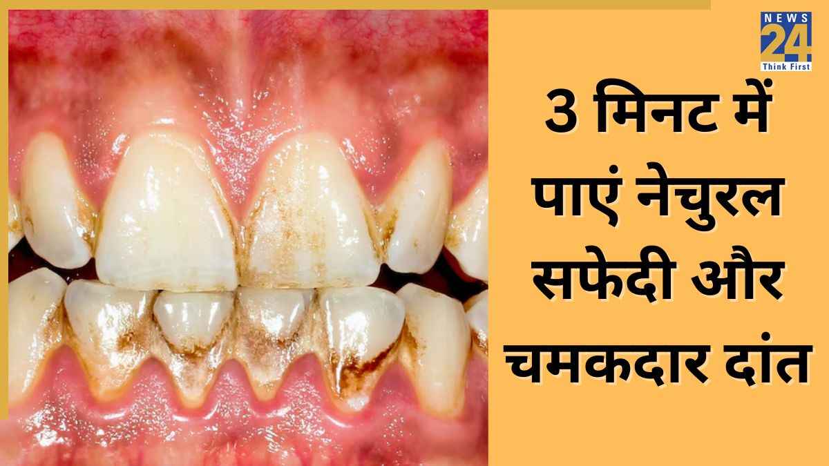 गुटखा खाने से दांत हो गए हैं लाल तो एकबार आजमाकर देख लीजिए एक्सपर्ट का बताया यह नुस्खा, दांतों पर आ जाएगी चमक