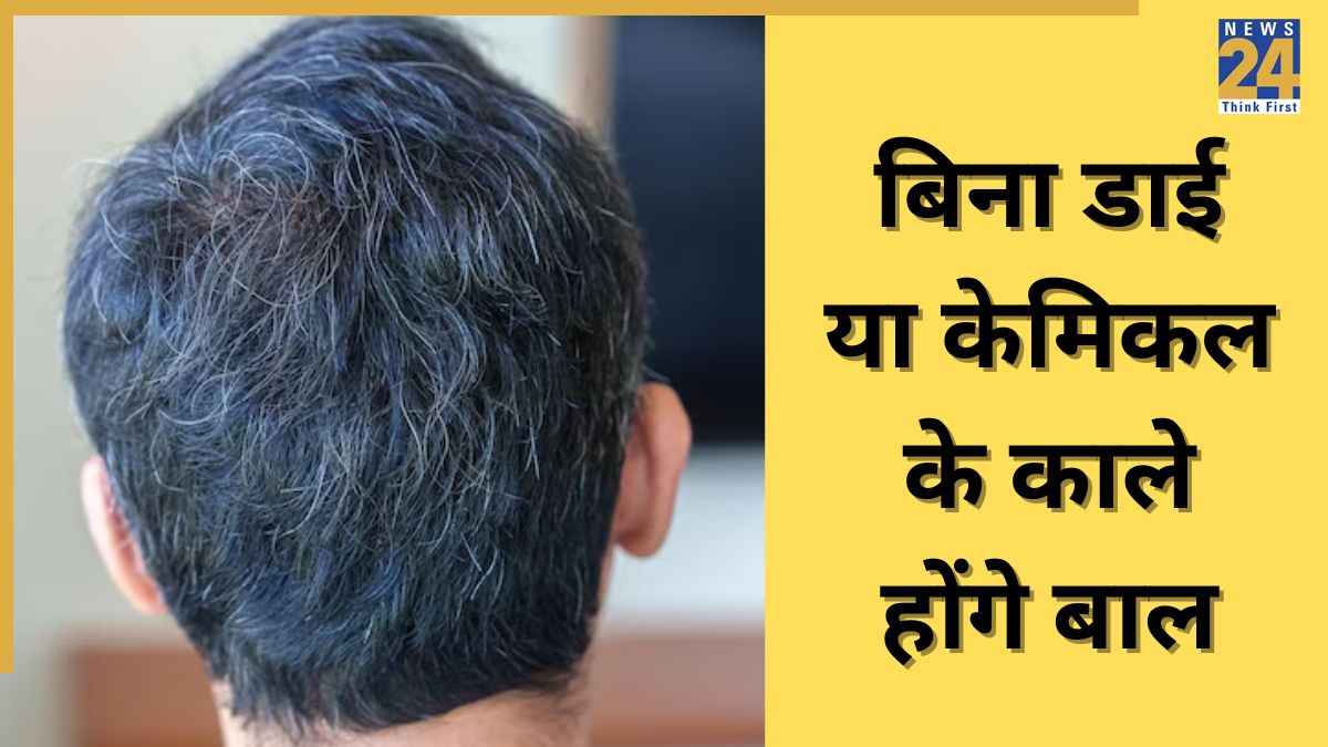 White Hair Home Remedies