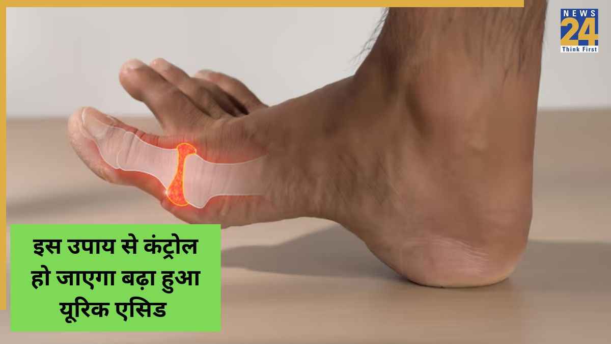 Natural uric acid remedy