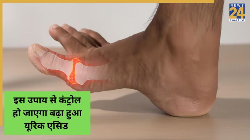 Natural uric acid remedy Natural uric acid remedy