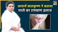 Acharya Balkrishna Mouth Ulcer Remedy
