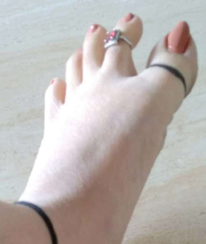 Black Thread In leg Thumb Black Thread In leg Thumb-1-2-3-4-5-6-7-8