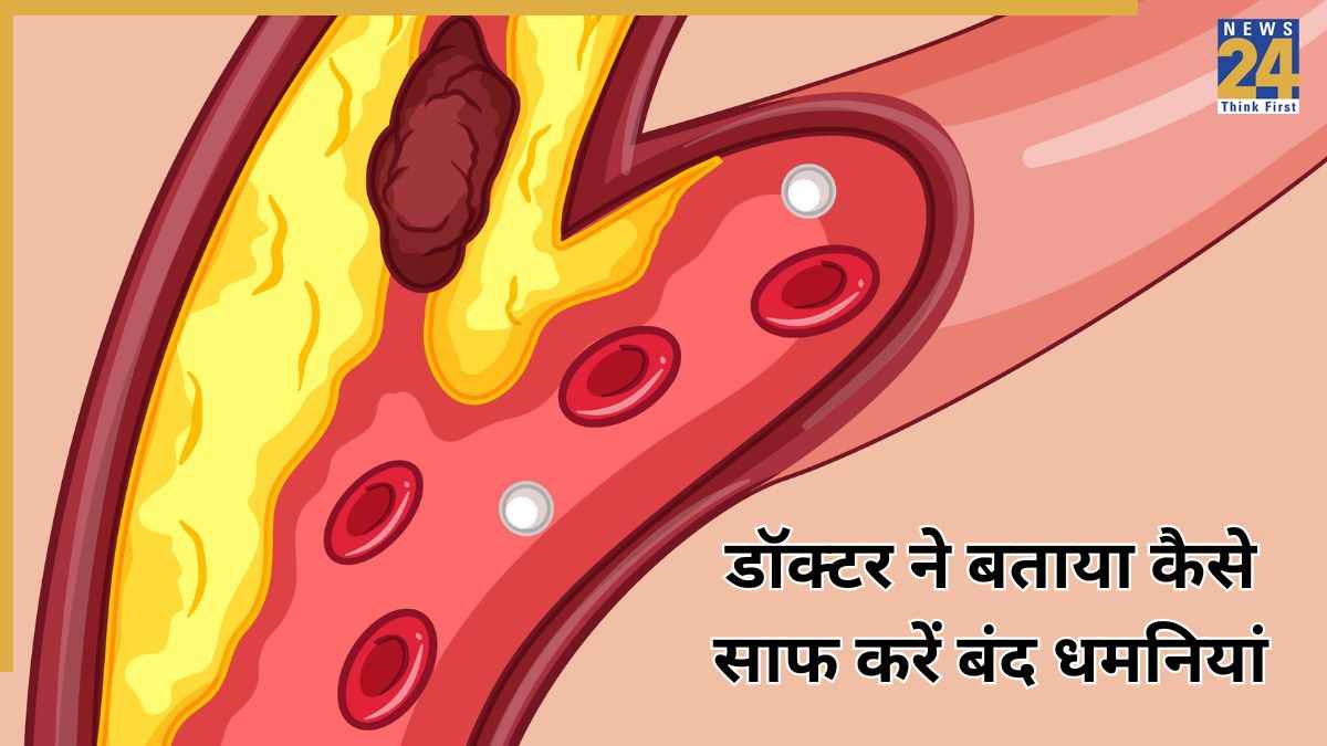धमनी ब्लॉकेज को कैसे अनब्लॉक करें? वेरिकोज वीन्स स्पेशलिस्ट ने बताया Blocked Arteries खोलने का तरीका