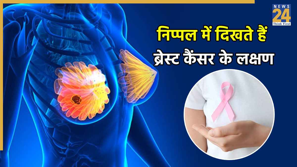 निप्पल में इन 3 बदलावों का होना है कैंसर के शुरुआती संकेत, डॉक्टर ने बताया महिलाएं कैसे करें पहचान?