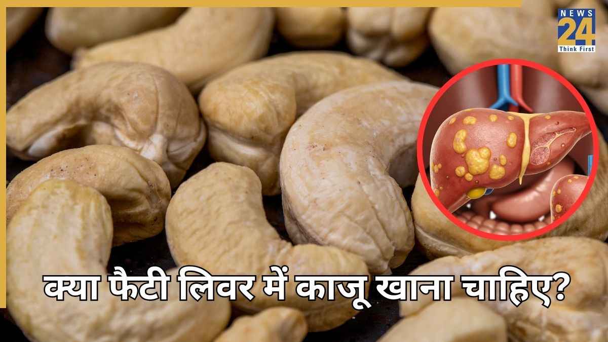 क्या काजू फैटी लिवर के लिए अच्छा है? लिवर ट्रांसप्लांट सर्जन ने बताया क्या Fatty Liver में ड्राई फ्रूट खाना चाहिए