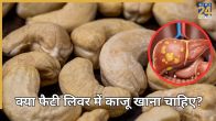 Cashews Fatty Liver