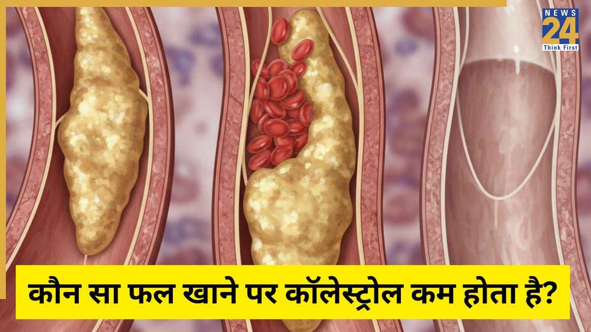 Cholesterol Diet