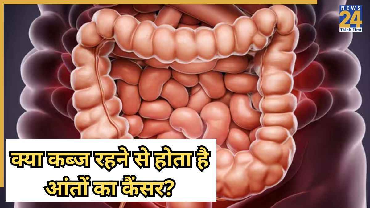 Stage 5 colon cancer symptoms