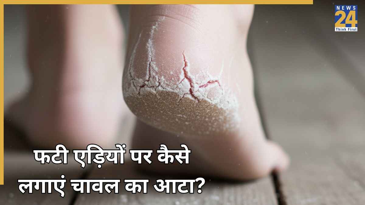 Cracked Heels