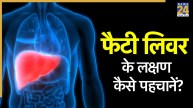 fatty liver signs