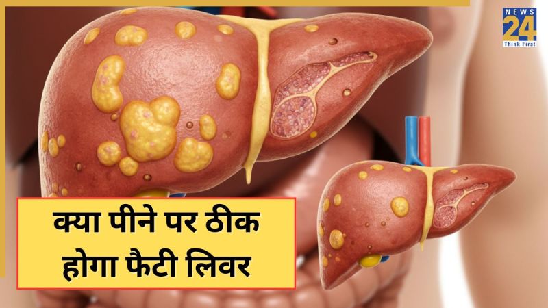 Fatty Liver Fatty Liver Disease