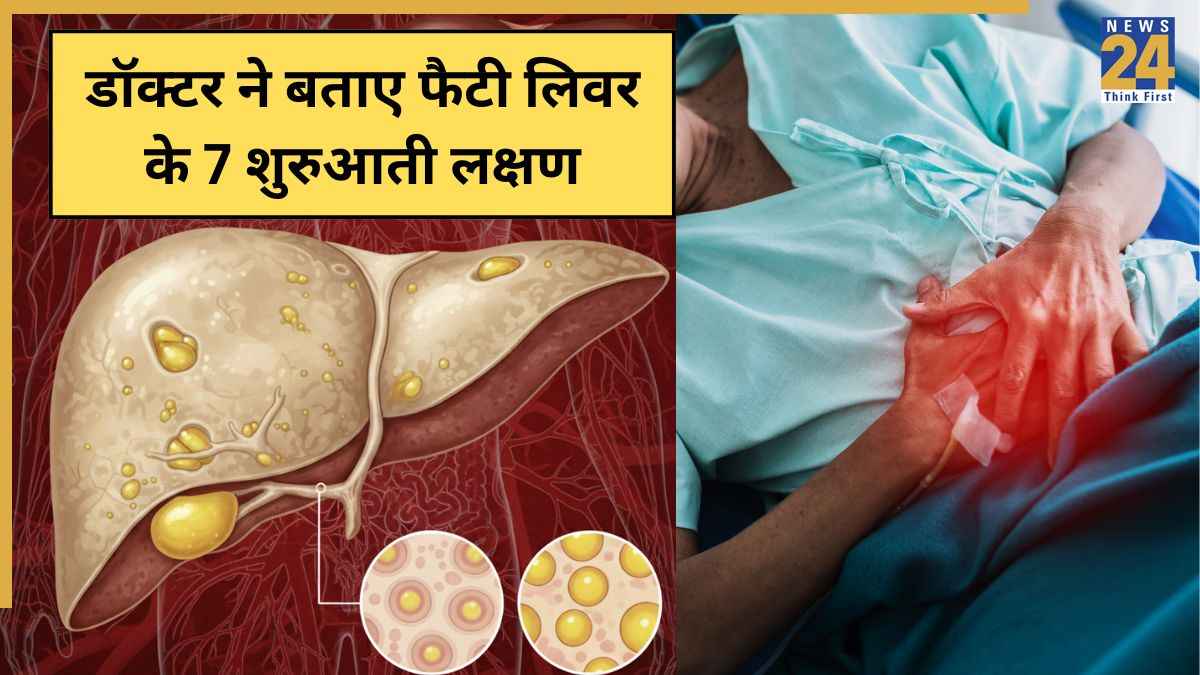 Fatty Liver Disease