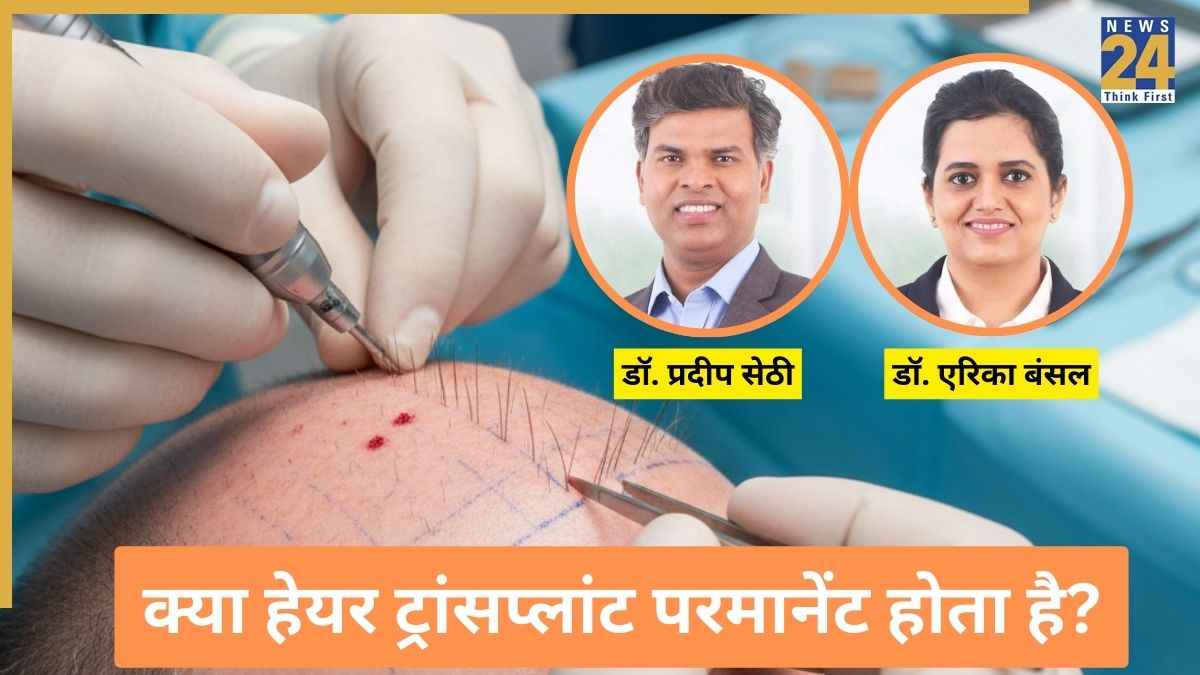 क्या हेयर ट्रांसप्लांट सच में उम्रभर चलता है? AIIMS के डॉक्टरों ने कहा Hair Transplant कराने से पहले जान लें ये बातें