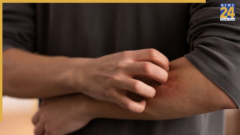 Khujli Hone Ke Lakshan Khujli Hone Ke Lakshan