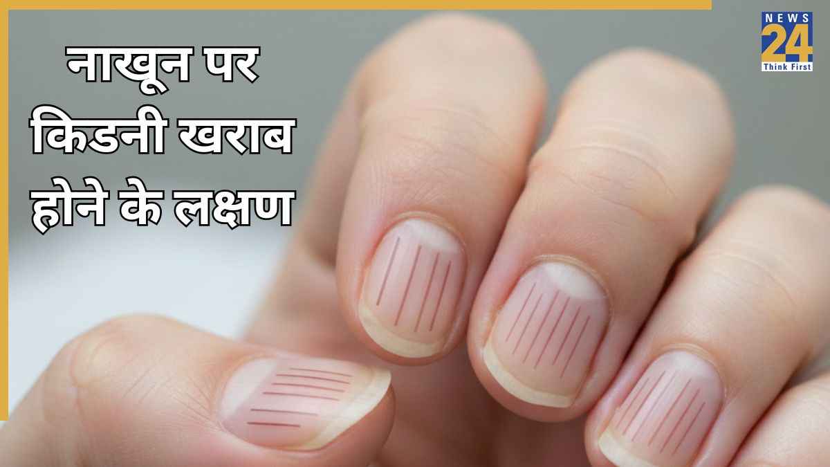 किडनी की बीमारी में नाखून कैसे दिखते हैं? यहां जानिए किडनी खराब होने के शुरुआती लक्षण क्या हैं