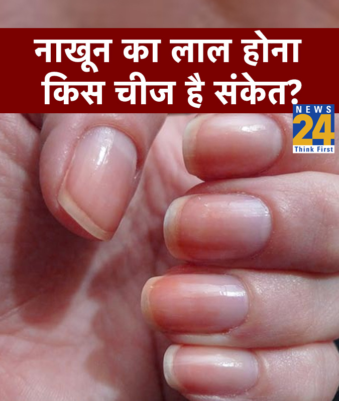 Nail Colour & Signs Meaning-1-2-3-4-5-6