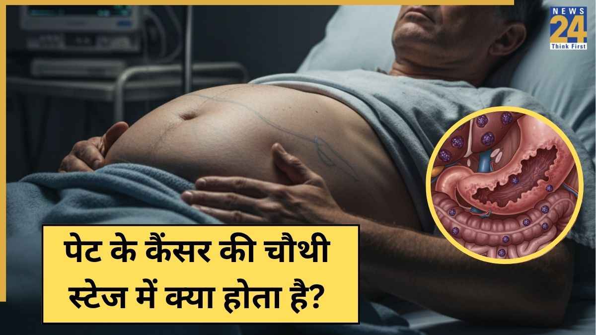 पेट के कैंसर की स्टेज 4 में कैसे लक्षण नजर आते हैं? यहां जानिए Stomach Cancer का इलाज कैसे होता है