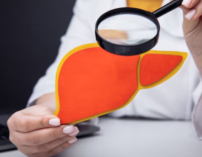 fatty liver fatty liver-1-2-3-4-5-6