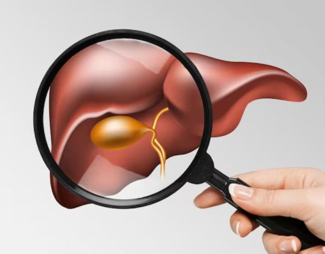 fatty liver-1-2-3-4-5