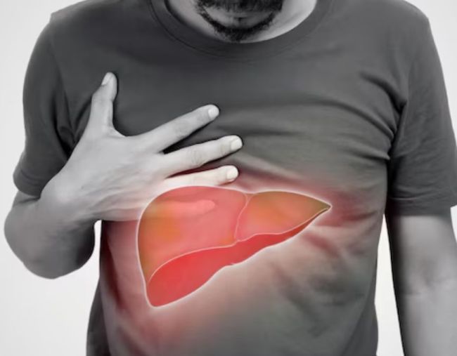 fatty liver-1-2-3-4