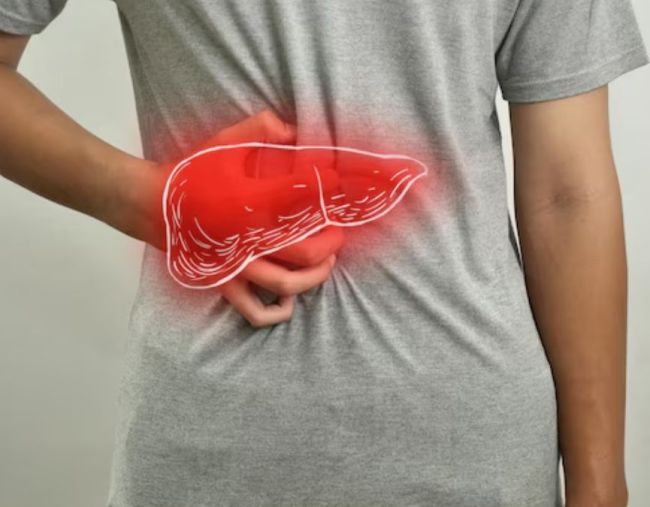 fatty liver-1-2-3