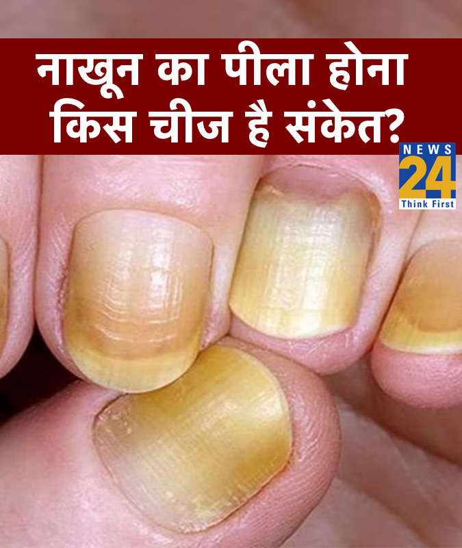 Nail Colour & Signs Meaning-1-2-3-4-5