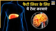 what test is used for fatty liver disease