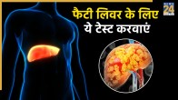 what test is used for fatty liver disease