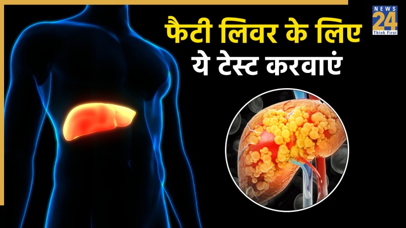 fatty liver symptoms and test what test is used for fatty liver disease