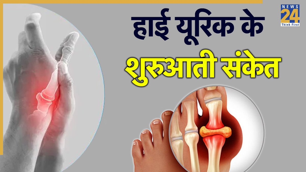 high uric acid symptoms-1