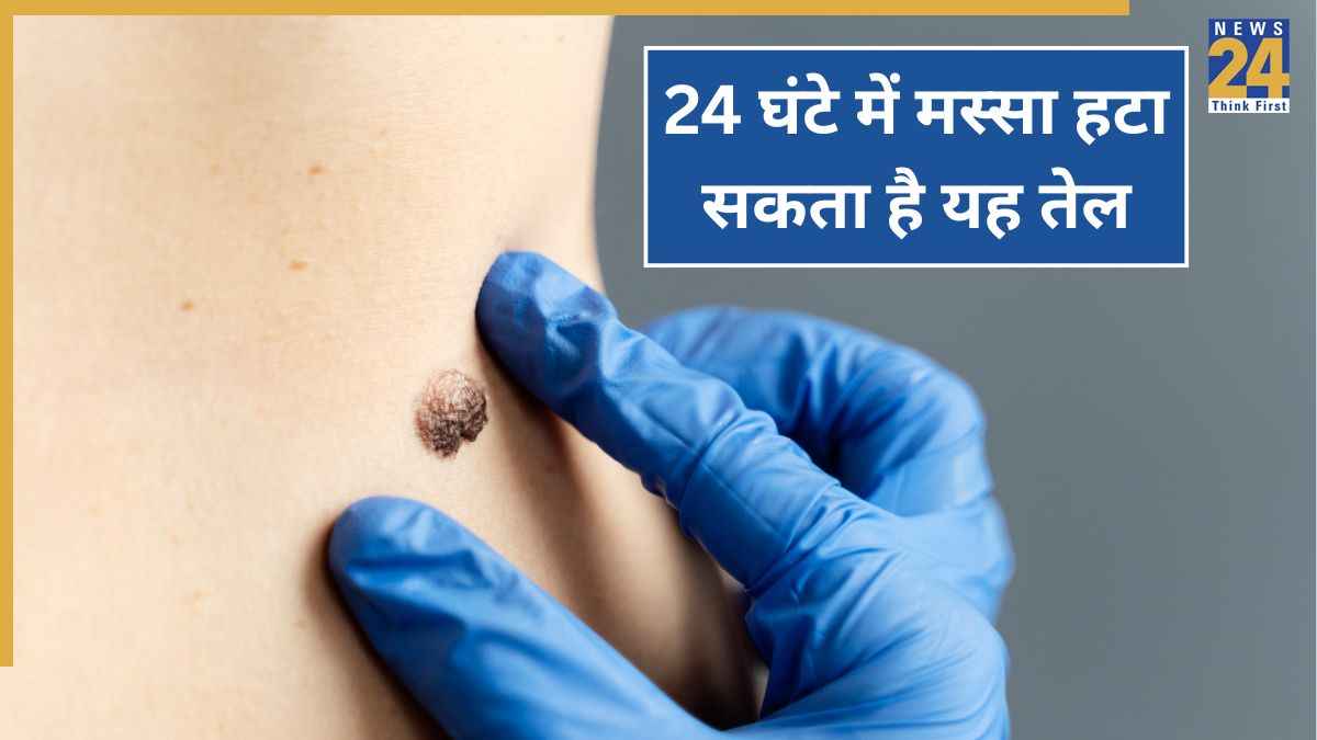 Massa Hatane Ka Tarika Skin Tags