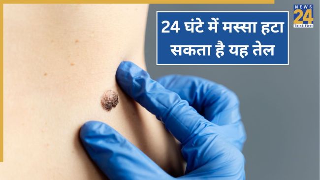 Massa Hatane Ka Tarika Skin Tags