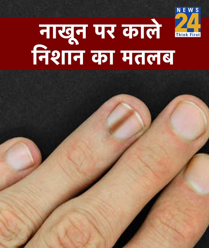 Nail Colour & Signs Meaning-1-2-3