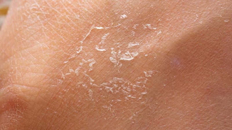 source- diabetes symptoms -1-2-3-4-5-6-7